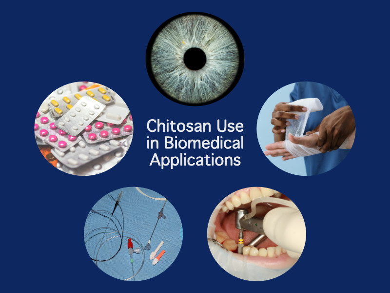 Chitosan-based coatings has many  biomedical applications, which are shown here, including drug delivery, wound dressings, catheters and stents, surgical implants, and Ophthalmic Applications