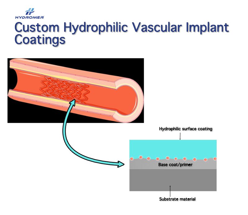 Stent coated with hydrophilic medical coating