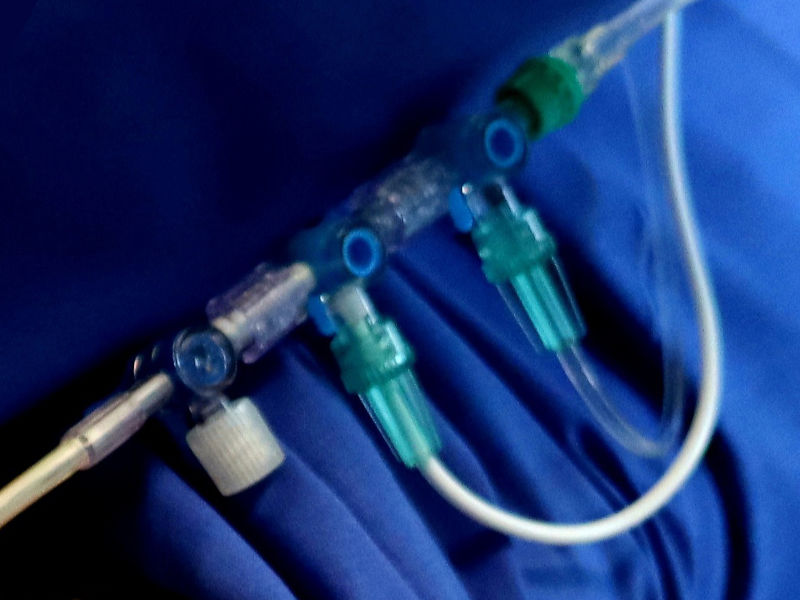 Polymer medical devices treated with hydrophilic coatings to increase surface energy. 